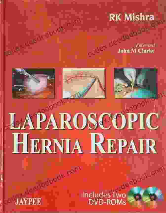 Dr. R.K. Mishra, Laparoscopic Hernia Repair Expert Laparoscopic Hernia Repair RK Mishra