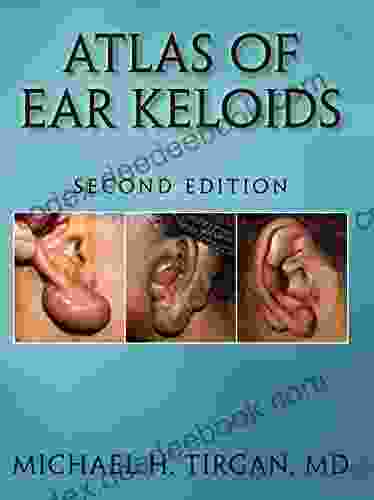 Atlas Of Ear Keloids Second Edition