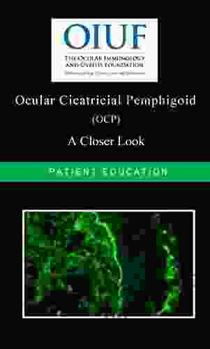 Ocular Cicatricial Pemphigoid: A Closer Look